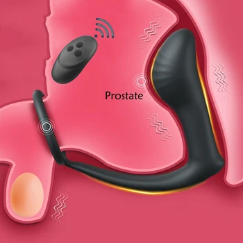 Prostate Massager Anal Vibrator Male Delay Ejaculation Ring Anal Plug Prostate Stimulator Cock Rings Vibration for Sex Toys 1