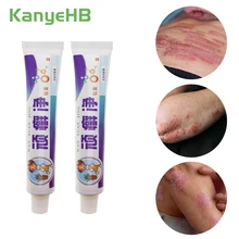 1pcs Skin Care Cure Psoriasis Ointment Ringworm Cream Tinea Eczema Treatment All Skin Types Natural Cream Eczema Skin Pruritus