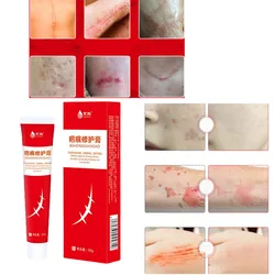 Scar Repair Ointment for Acne Scars Operation Scar Care Topical Smear OintmentAcne Scar Cream Facial Gel Acne Treatment