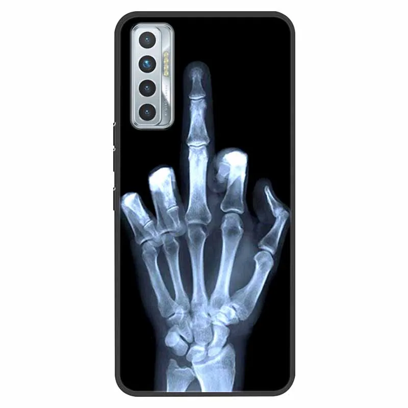 Cute Cartoon Shockproof Soft Silicone TPU Back Cover