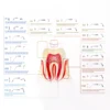 1pc Dental Ultrasonic Scaler Tip Scaling Periodontics Endodontics Dentists Multifunction Endo Perio Scaling Tips G P E ► Photo 2/6