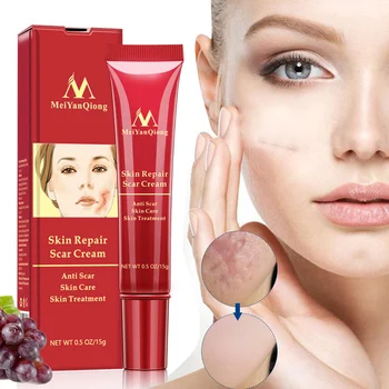 

Acne Repair Gel Cream Acne Scar Treament Skin Repair Whitening Moisturizing Cream Skin Care KG66