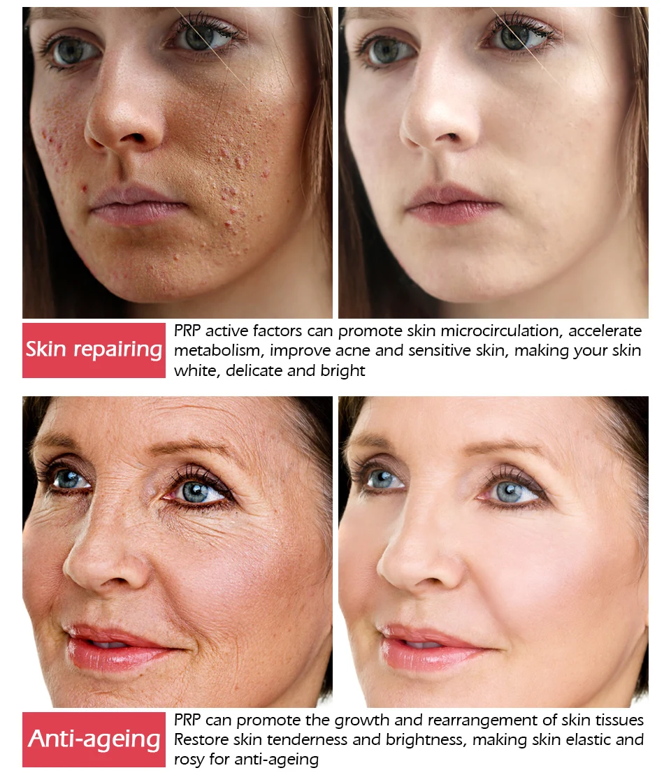 血清蛋白无水面膜_05(1)