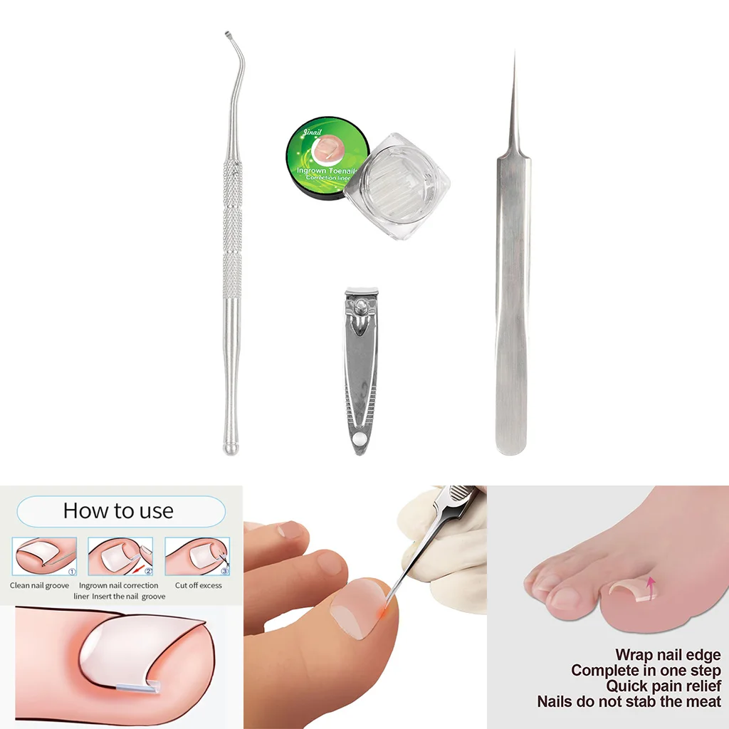 Professional Ingrown Toenail Lifter Correction Tools Toe Nail File Clippers Nail Cleaner Manicure Pedicure Podiatry Tool Professional Ingrown Toenail Lifter Correction Tools Toe Nail File Clippers Nail Cleaner Manicure Pedicure Podiatry Tool