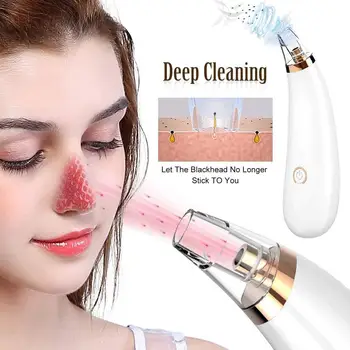 

3-in-1 Blemish and Blackhead Removal Electric Vacuum Pore Cleaner Beauty Device