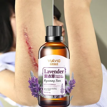 

Scar Repair Essential Oil Remove All Kinds of Scars Pimple Marks Lavender Essence