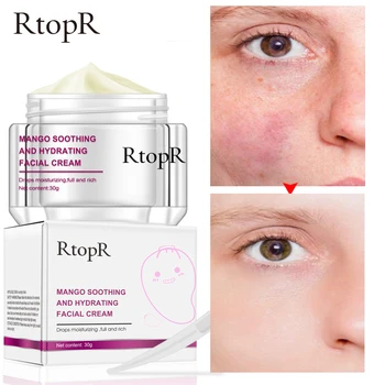 

RtopR Mango Moisturizing Facial Cream Anti-Wrinkle Anti Aging Whitening Liquid Tights Nourishing Shrink Pores Hyaluronic Acid