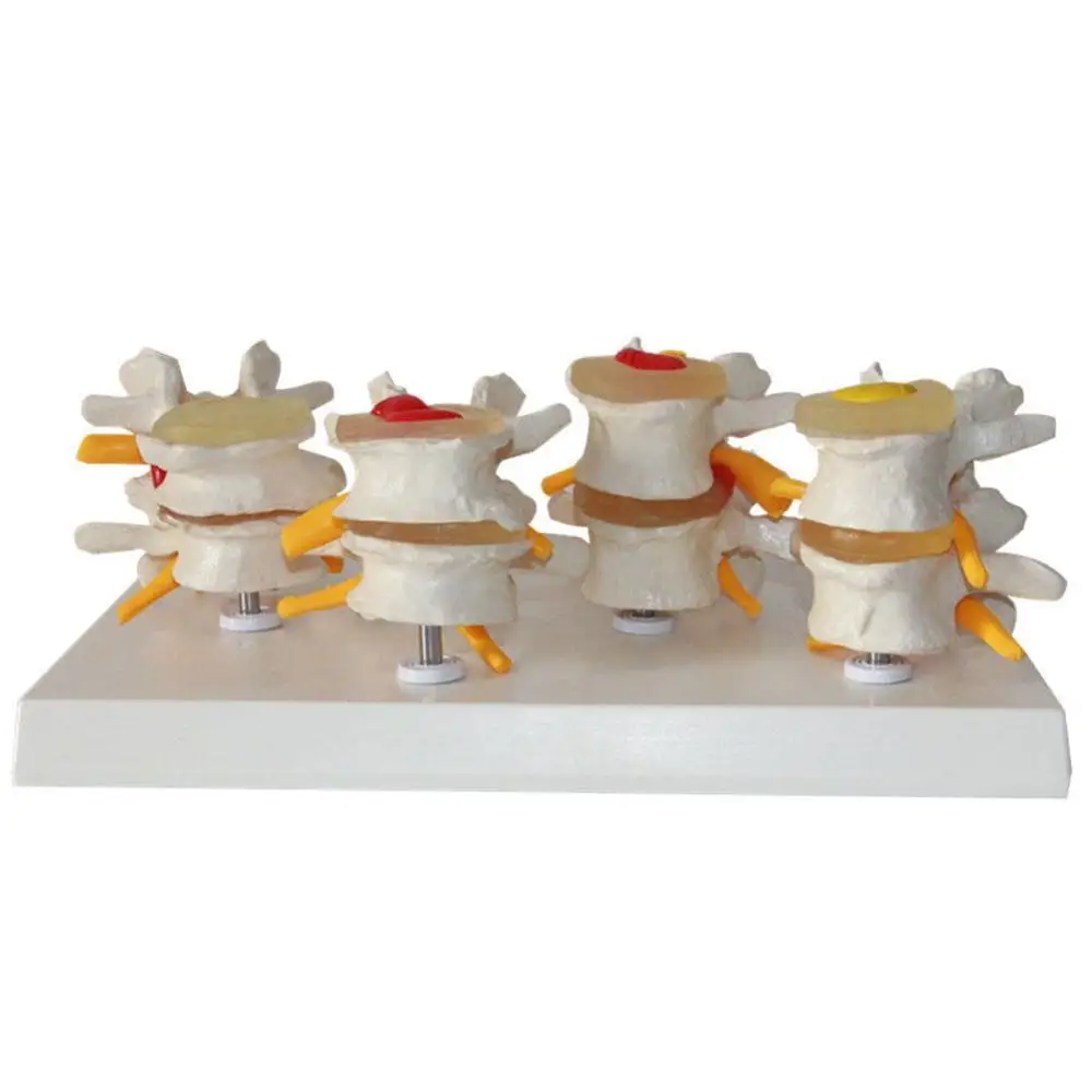 Медицинская модель позвоночника 4 этапа|model anatomy|medical teaching modelanatomy model |