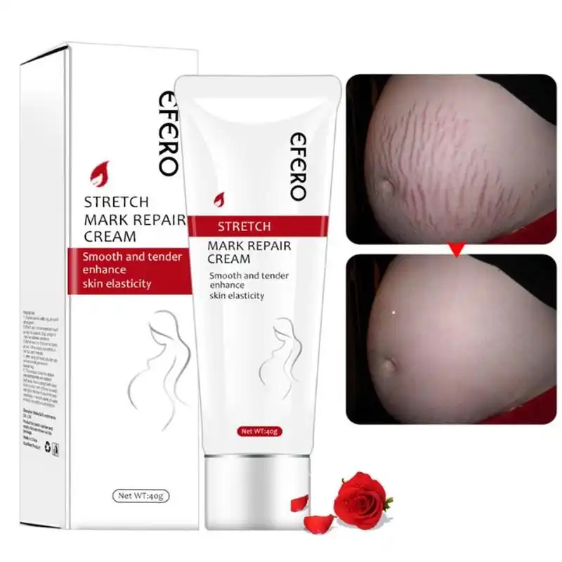 efero stretch mark cream