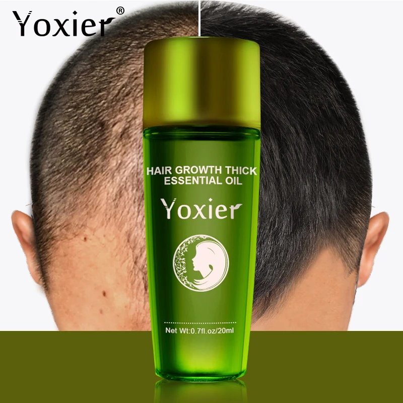 Yoxier New Hair Growth Essence Oil Effective Extract Anti Nourish Hair Roots Treatment Preventing Hair Loss 2