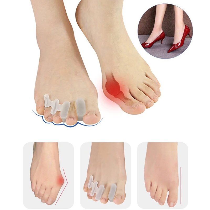 1Pair Corrector Toe Protector Silicone Bunion Thumb Valgus Protector Preventing Blisters Nail Tools Foot Care Toe Separators