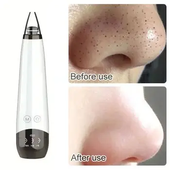 

Blackhead Remover Face Deep Nose Cleaner Acne Pore Cleaner Acne Pimple Removal Vacuum Suction Electric Instrument