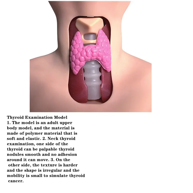 Is it common to have a red neck with a thyroid ... - Thyroid UK