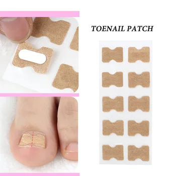 

Ingrown Toenail Corrector Sticker Nail Care Tool Paronychia Treatment Fixer Recover Corrector Pedicure Foot Toe Glue Free