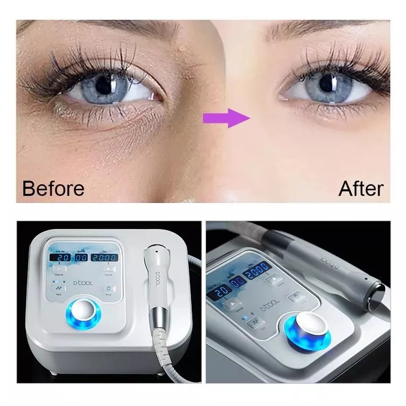 New 2024 Sliming Dcool Portable Cool Hot EMS For Skin Tightening Anti Puffiness Facial Electroporation Machine Beauty Device 5