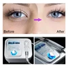 New 2024 Sliming Dcool Portable Cool Hot EMS For Skin Tightening Anti Puffiness Facial Electroporation Machine Beauty Device 5