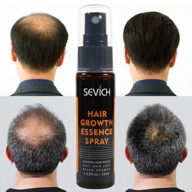 Sevich-Spray para el crecimiento del cabello, esencia de plantas para tratamiento del cabello, Anti-Prevención de la pérdida de cabello, producto para reparación del cabello más rápido, 30Ml