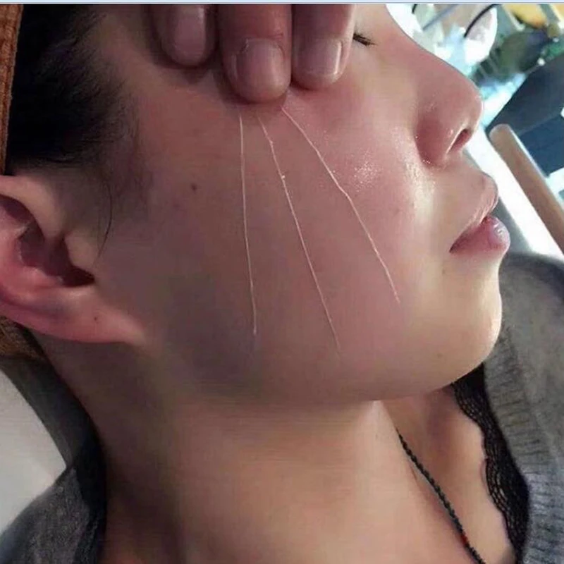 Face Filler Absorbable Collagen Based Protein Thread FaceLift Silk Fbroin Line Carving Essence Face Care Skin Rejuvenating