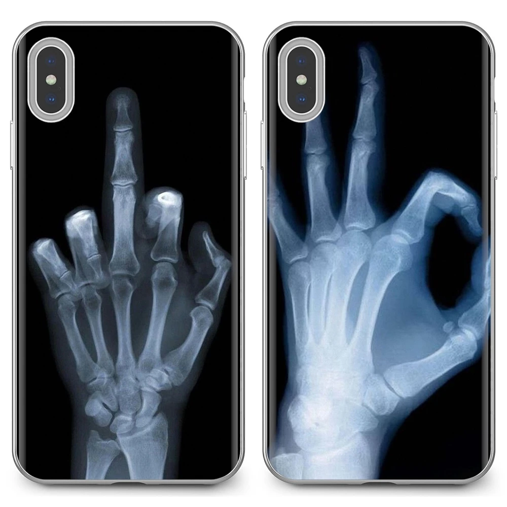 For Huawei Mate Honor 4C 5C 5X 6X 7 7A 7C 8 9 10 8C 8X 20 Lite Pro Amazing Silicone Phone Case Wolverine X-ray Hand Bones Poster | Мобильные