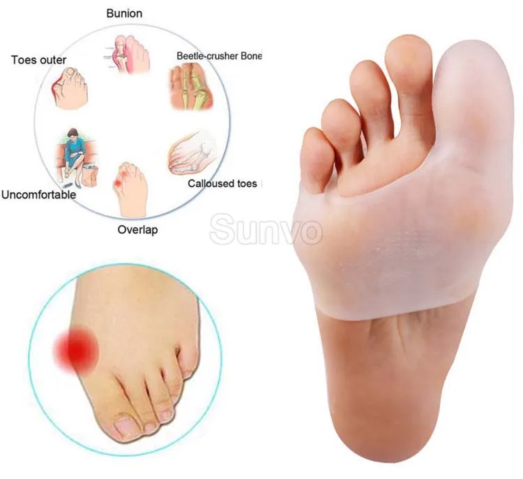 Sunvo 2 шт sinlicon Hallux вальгус палец ноги сепаратор силиконовые стельки для пальцев, накладные пальцы, приспособление для выравнивания пальцев, облегчающее боль