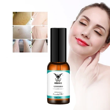 

Chicken Skin Folliculitis Treatment Exfoliating Shrink Pores Keratosis Pilar Remover Essential Oil