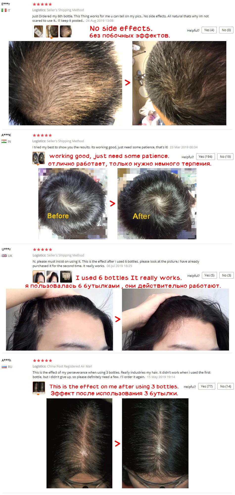 OMY LADY Fast Hair Growth Serum Anti Hair Loss Spray Essential Oil