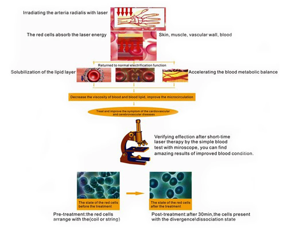 --machine-low-level-laser-therapy-wrist-watch-blood-pressure (8)