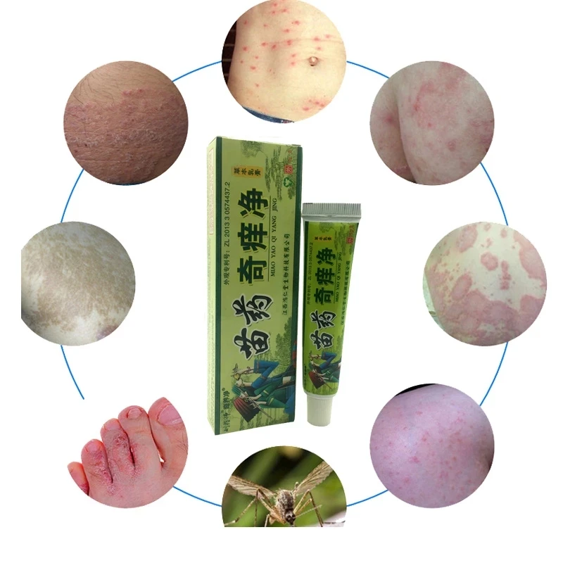 Body-Herbal-Material-Psoriasis-Creams-and-Eczema-Psoriasis-Ointment-Skin-Care-Health-Products-body-cream.jpg_Q90.jpg_.webp (2)