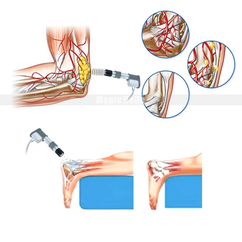 Hot! Double Channel Physical Pain Therapy System Acoustic Shock Wave Machine For Pain Relief Reliever ED Treatment Body Slimming