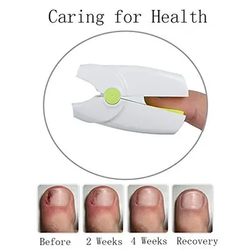 

Nail Cleaning Laser Device Nail Fungus Treatment Nail Fungus Remover Yellow Fungi Nail Solution
