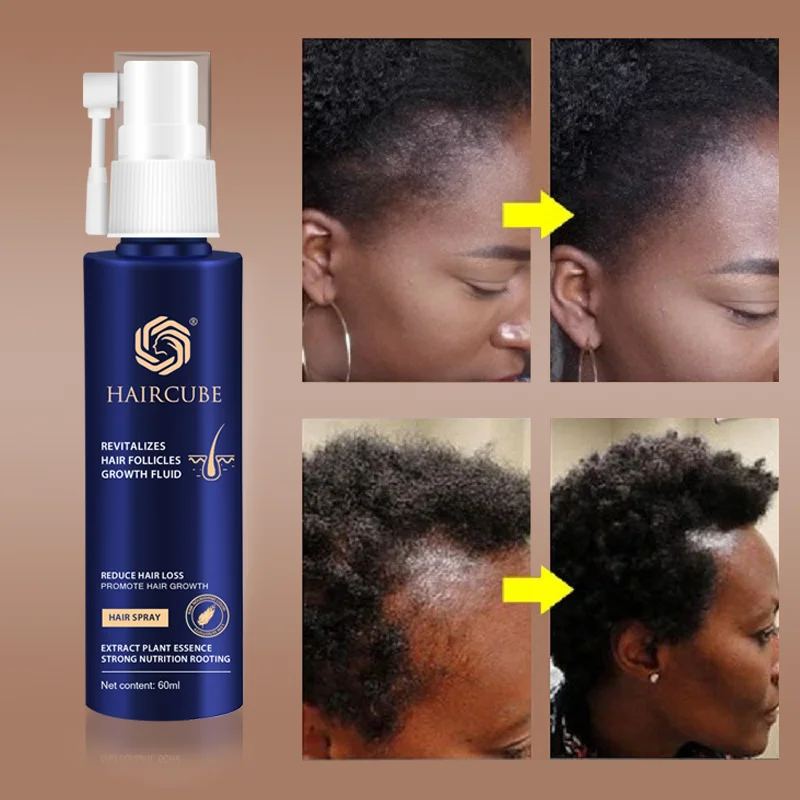 Hot Item Products Hair-Care Health-Treatment Herbal Natural Fast Thicker Makes And 60ml J9j9dZNZ6