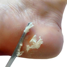 Outils de manucure et pédicure, rasoir pour les orteils, Kit de couteaux de pédicure pour les pieds, râpe à callosités, lime, dissolvant de peau morte, outils de soins des pieds