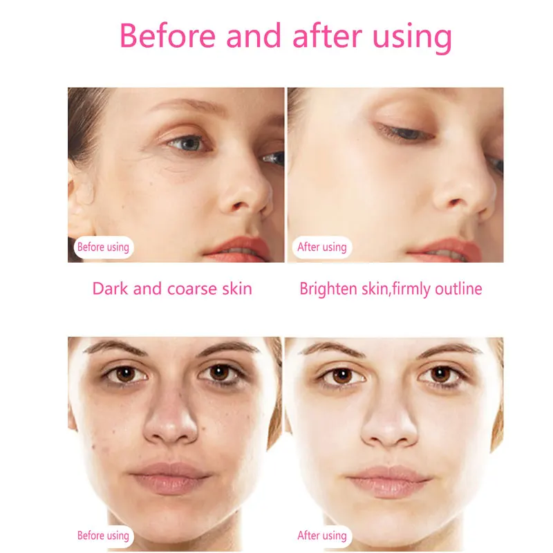 Electric Microcurrent Face Massager 42℃ Hot Compress Heat Vibration Facial Lifting LED Photon Skin Tighten Scraping Massage Tool_voghion.com