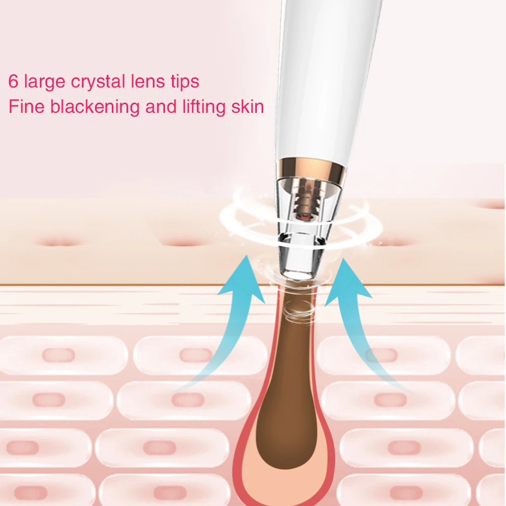 ABS Black Head Cleaner очищающее средство для лица эффективное быстрое очищающее средство от черных точек оборудование для удаления ясного ухода за кожей мода
