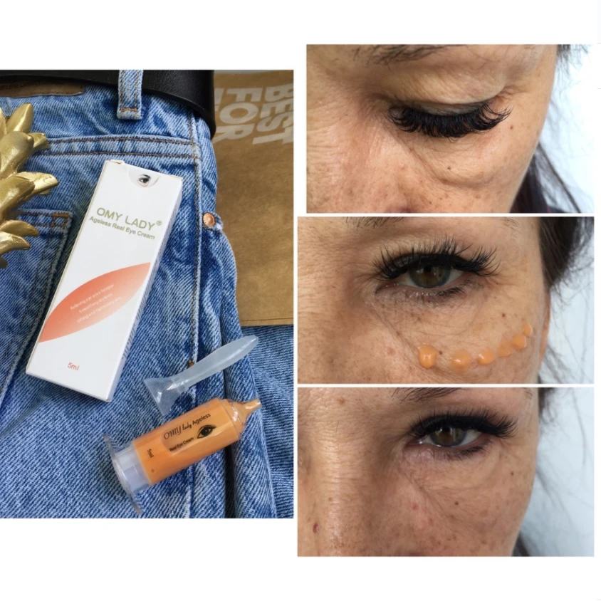 OMY LADY 5 шт. EyeCream мгновенное удаление очков укрепляющие глаза против отечности