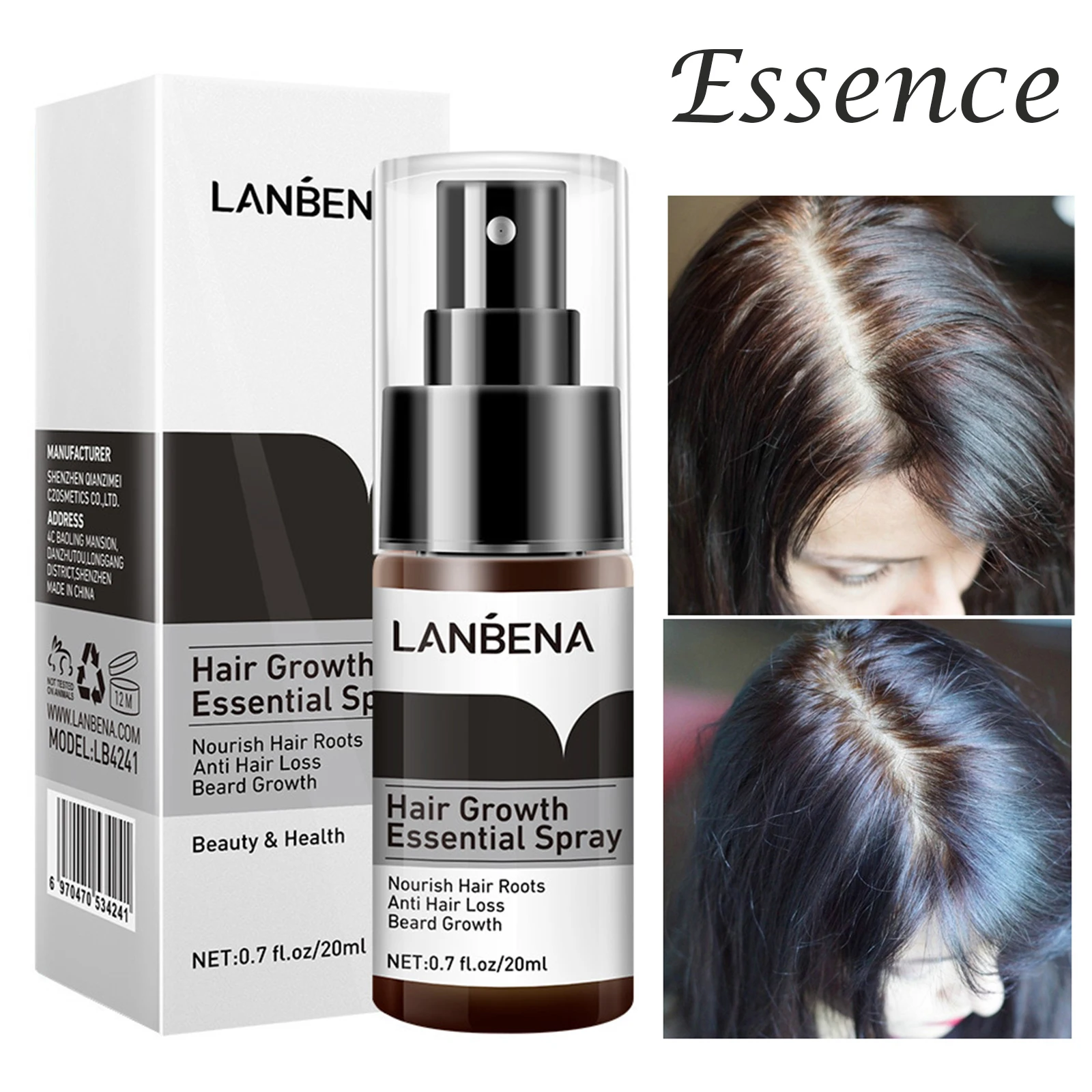 Raízes do Cabelo Crescimento do Cabelo Spray da Essência do Crescimento do Cabelo para Impedir a Calvície Forte Nutrir Rebrota Spray da Essência do para Impedir a Calvície h 1 crescimento do cabelo para impedir a calvície