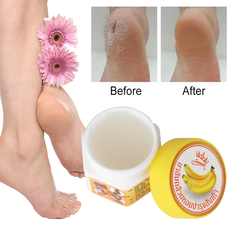 Anti Fungal Hand Foot Heel Anti-Drying Crack Repair Banana Oil Massage Cream Nourish Gentle Skin Care Anti Chapped Peeling Dead