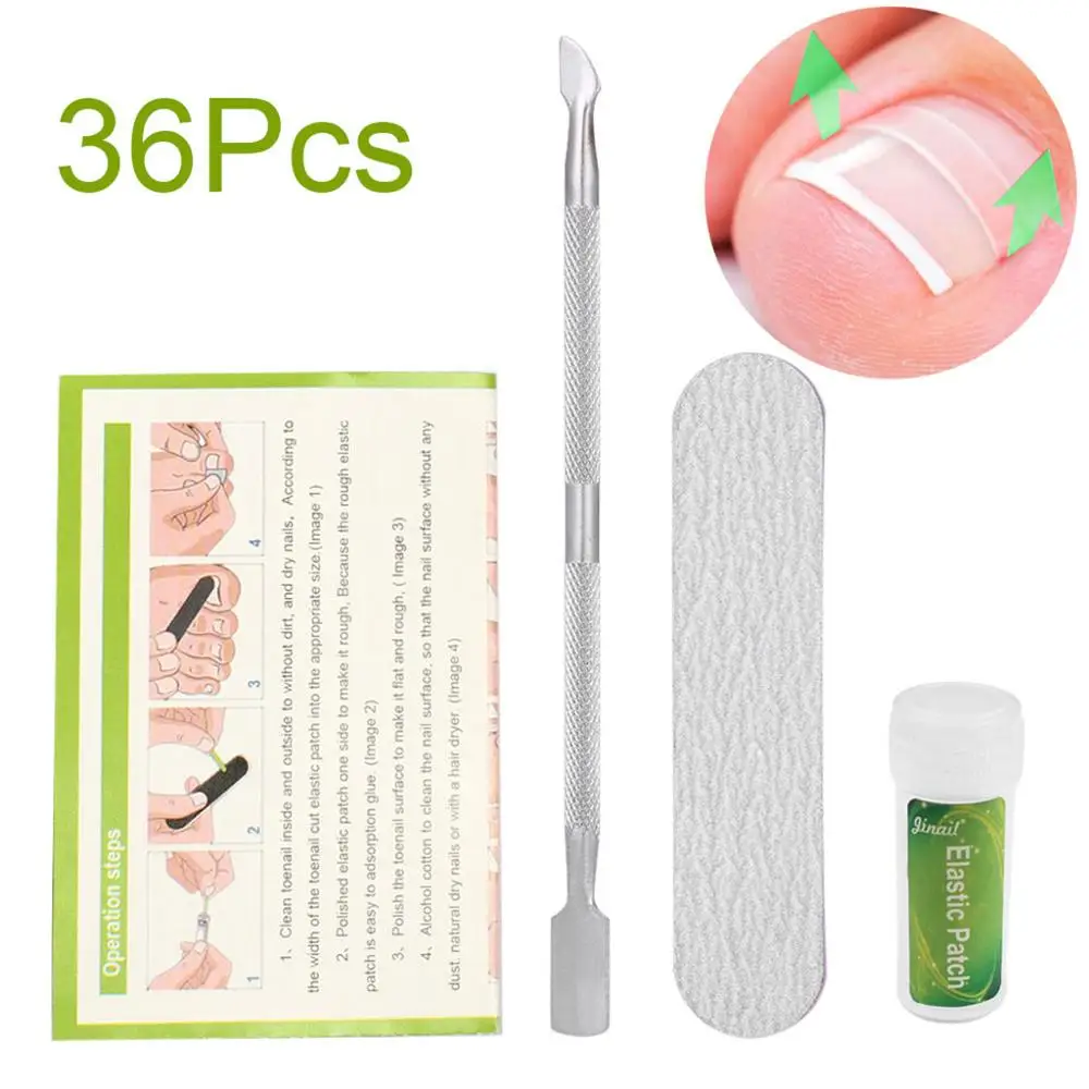 3-36pcs 3 шт./компл. вросших ногтей ног Коррекция педикюра Ремкомплект фиксаж удалитель корректор X5XC - Цвет: 3-36pcs