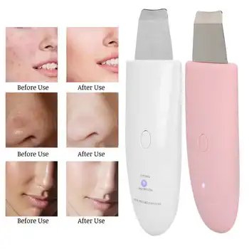 

Ultrasonic Skin Scrubber Deep Face Cleaning Machine Peeling Shovel Facial Pore Cleaner Face Skin Scrubber Lift Machine
