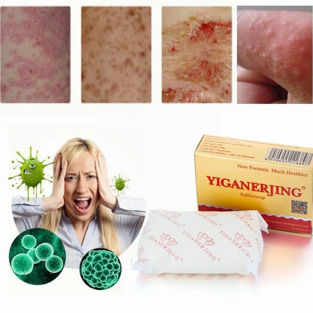 

1pcs sulphur Soap Skin Repair Acne Psoriasis Seborrhea Eczema Anti Fungus Bath Whitening Shampoo Body Lotion
