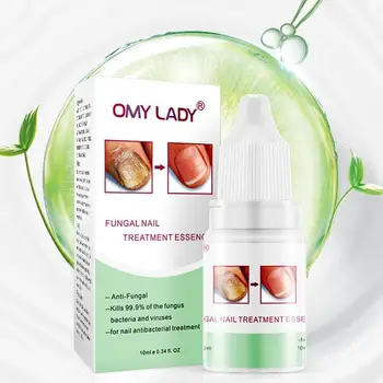 

10ml OMY LADY Fungal Nail Treatment Essence Foot Nail Onychomycosis Paronychia Infection Serum Repair Fungus Anti W7X8