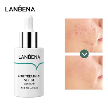 

LANBENA Serum Treatment Acne Oilgopeptide Anti Acne Solution Reduce Mark Shrink Pores Deep Repair Strengthen Skin Bottom 30ML