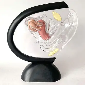 

Transparent Uterus Model Pathological Uterine Manikin instruments traumaticl medical skeleton anatomy training Simulator pratice