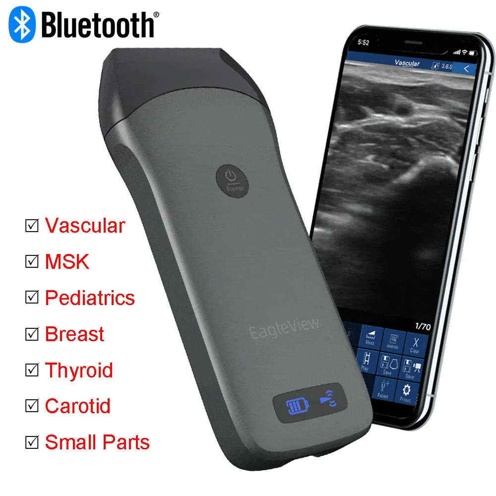 Thyroid Pediatrics Handheld Ultrasound Probe Scanner Vascular Msk Body