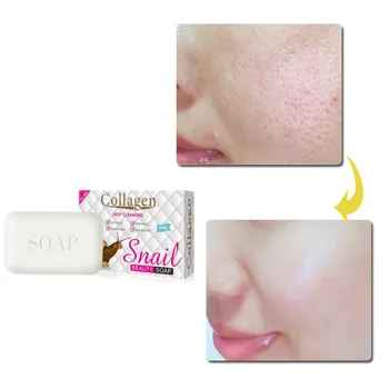 

Snail whitening soap Hyaluronic acid nourishes and moisturizes Moisturize and shrink pore, prevent acne and blackhead skin soap