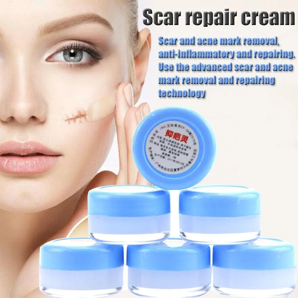 permanent acne removal cream