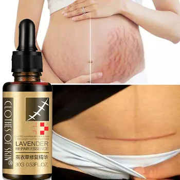 

Lavender Repair Essence Scar Removal Essential Massage Oil For Pregnant Women Hyaluronic Acid Serum Oil Essential Face Anti Acne