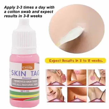 

10ml Genital Skin Tag Remover Foot Corn Wart Treatment Papillomas Removal Liquid Against Moles Wart Remover Skin Care Products