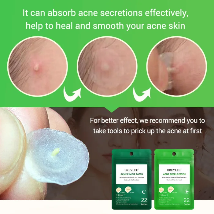 Tea Tree Skin Patch Acne Pimple Patch Reduce Invisible Stickers for Skin Care JS11