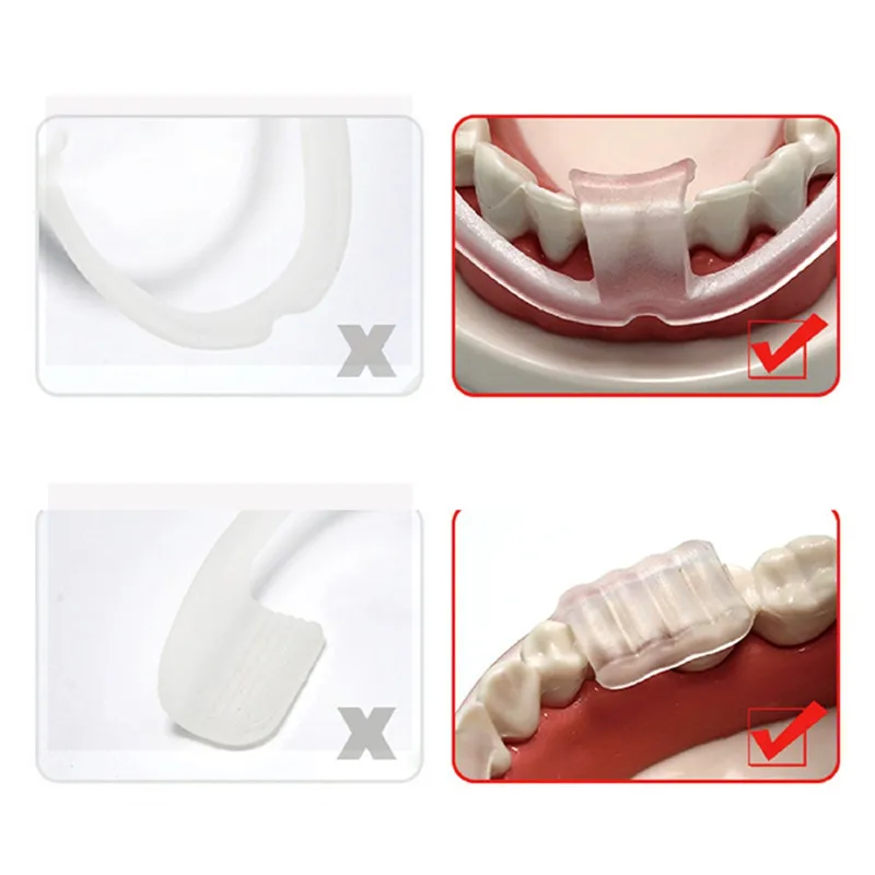 

Mouth Guard Teeth Protector Youth Sport Children Mouthguard Tooth Brace Protection For Basketball Rugby Boxing Karate